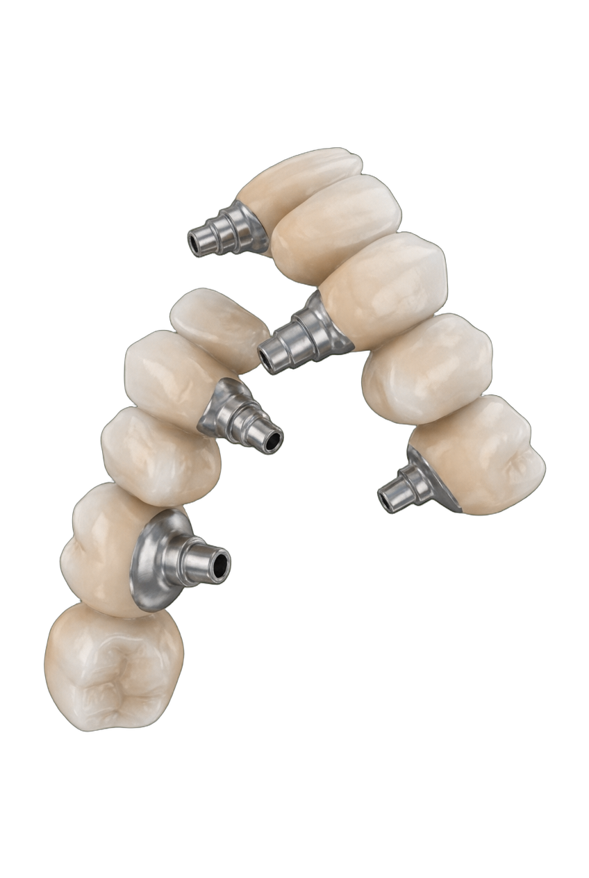 Восстановление зубов <strong>по методике All-on-4</strong>