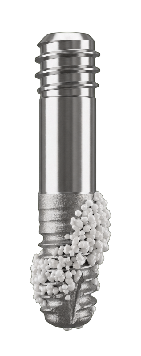 Синус-лифтинг <strong>для успешной имплантации</strong>