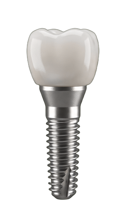 При установке имплантата <strong>удаление зуба бесплатно</strong>