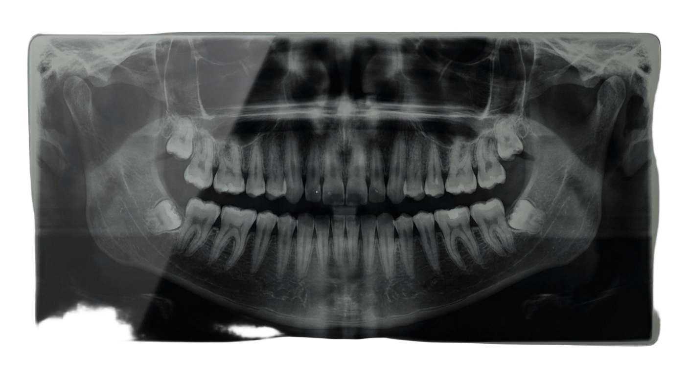 Рентгенография <strong>зубов в Аркобалено</strong>