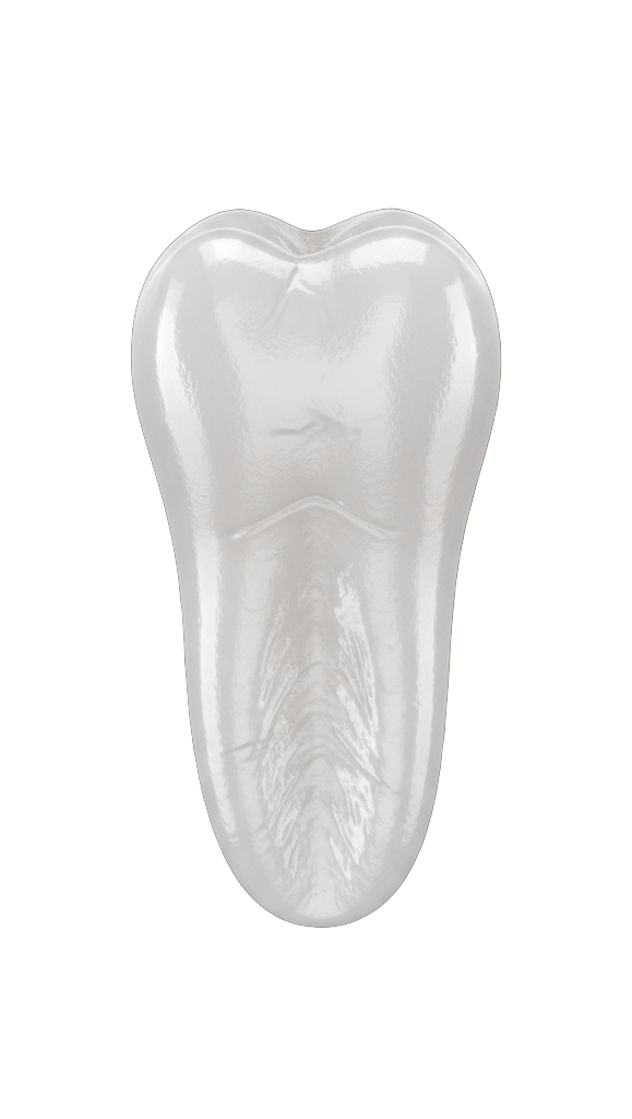 Установка <strong>вкладок</strong> на зубы