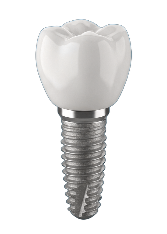 Имплантация <strong>зубов в Красногорске</strong>