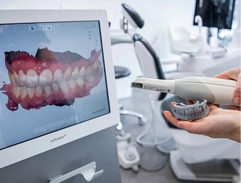 Внутриротовой сканер